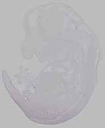 EMAGE:16089