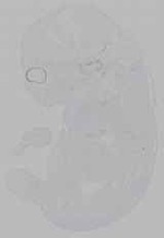 EMAGE:16110