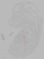 EMAGE:16131