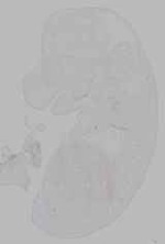 EMAGE:16131