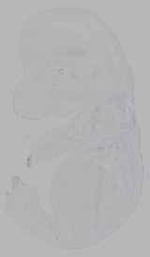 EMAGE:16146