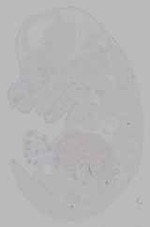 EMAGE:16151