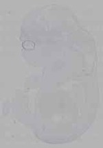 EMAGE:16156