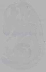 EMAGE:16156