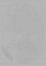 EMAGE:16166