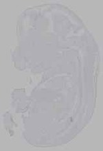 EMAGE:16179