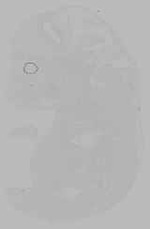 EMAGE:16209