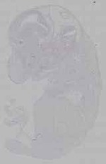 EMAGE:16224