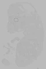 EMAGE:16228