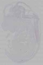 EMAGE:16271