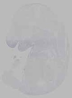 EMAGE:16279