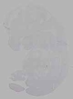 EMAGE:16304