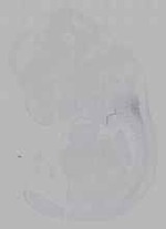 EMAGE:16309