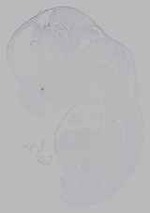 EMAGE:16310