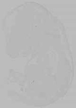 EMAGE:16349