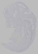 EMAGE:16361