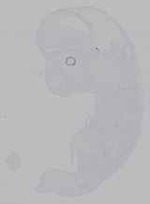 EMAGE:16361