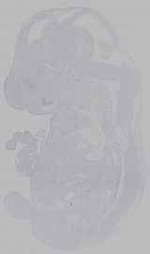 EMAGE:16379