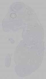 EMAGE:16379