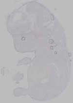 EMAGE:16399