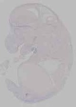 EMAGE:16464