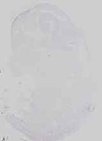 EMAGE:16474