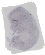 EMAGE:16478