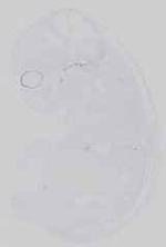 EMAGE:16479
