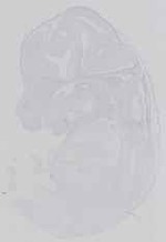 EMAGE:16479
