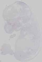 EMAGE:16484