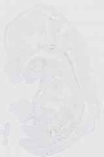EMAGE:16491