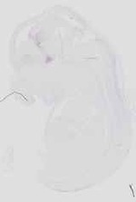 EMAGE:16502