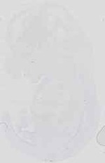 EMAGE:16539
