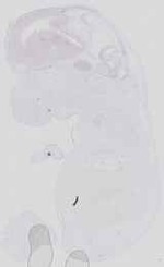 EMAGE:16543