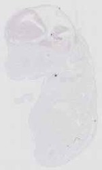 EMAGE:16552