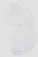 EMAGE:16555