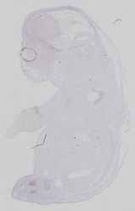 EMAGE:16562