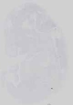 EMAGE:16569