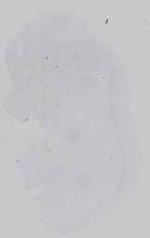 EMAGE:16571