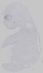 EMAGE:16572