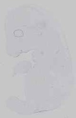 EMAGE:16572