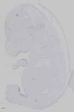 EMAGE:16572