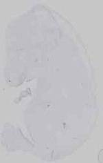 EMAGE:16572