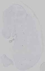 EMAGE:16572