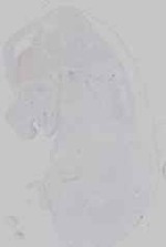 EMAGE:16572