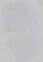 EMAGE:16572