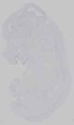 EMAGE:16572