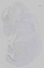 EMAGE:16572