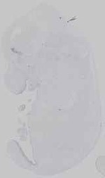 EMAGE:16572