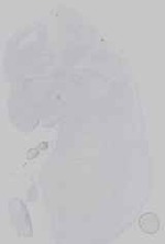 EMAGE:16572